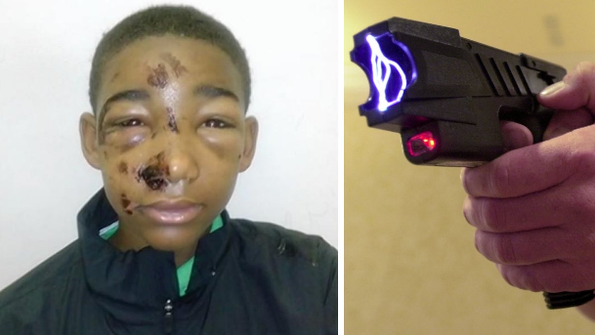 Polis sköt 14-årig snattare i ansiktet med en elpistol. 